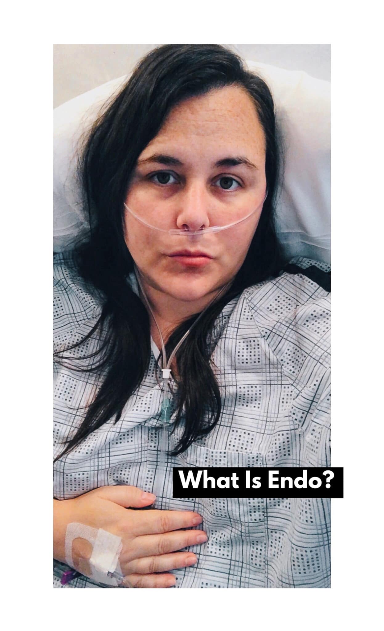 WHAT IS ENDO?